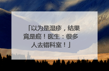 以为是湿疹，结果竟是癌！医生：很多人去错科室！
